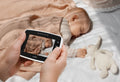 NUVITA - 360 Video Voice Monitor 3045